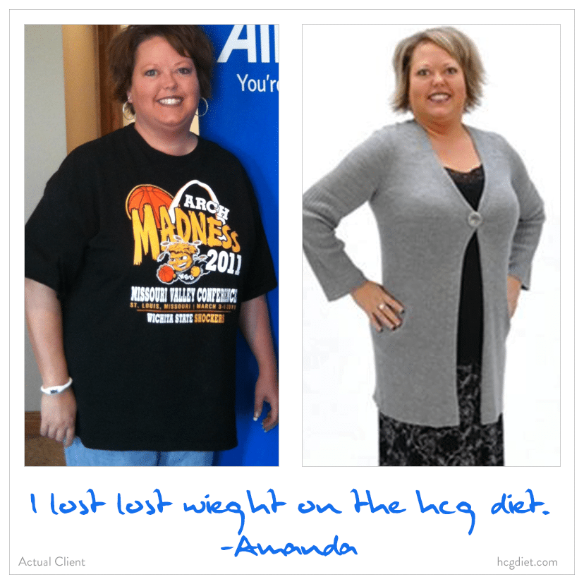 Amanda lost weight on the HCG Diet