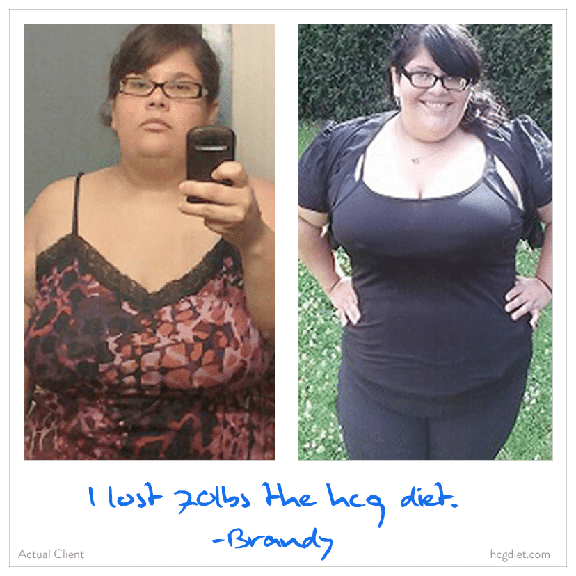 Brandy Lost 70 pounds on the HCG Diet