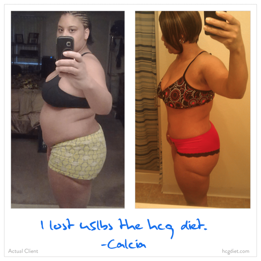 Calcia lost 45 pounds on the HCG Diet