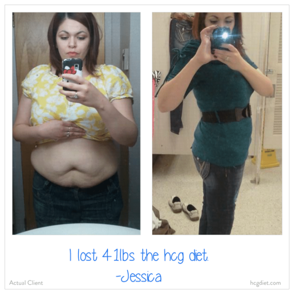 HCG Weight Loss success story 3