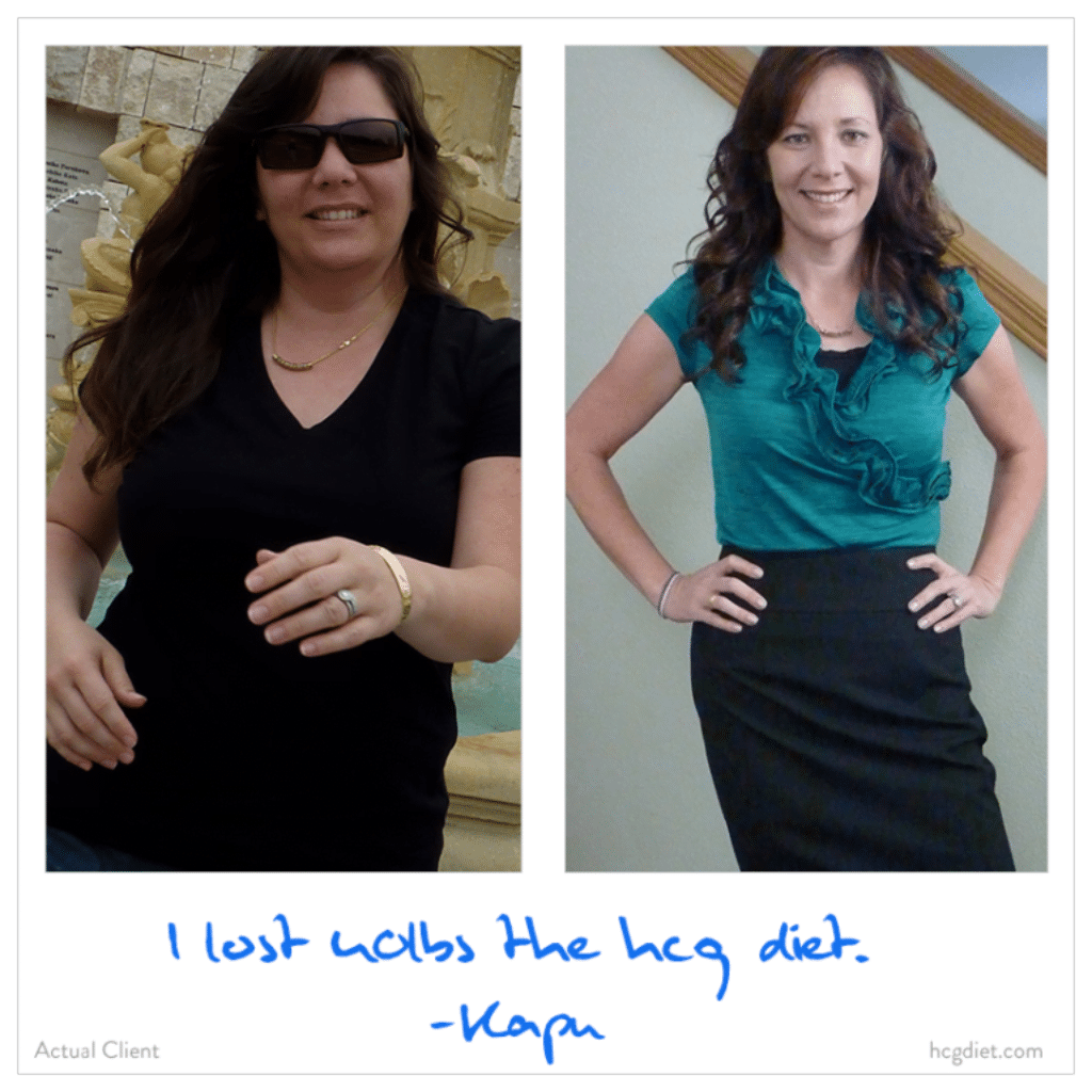 HCG Weight Loss success stories 1