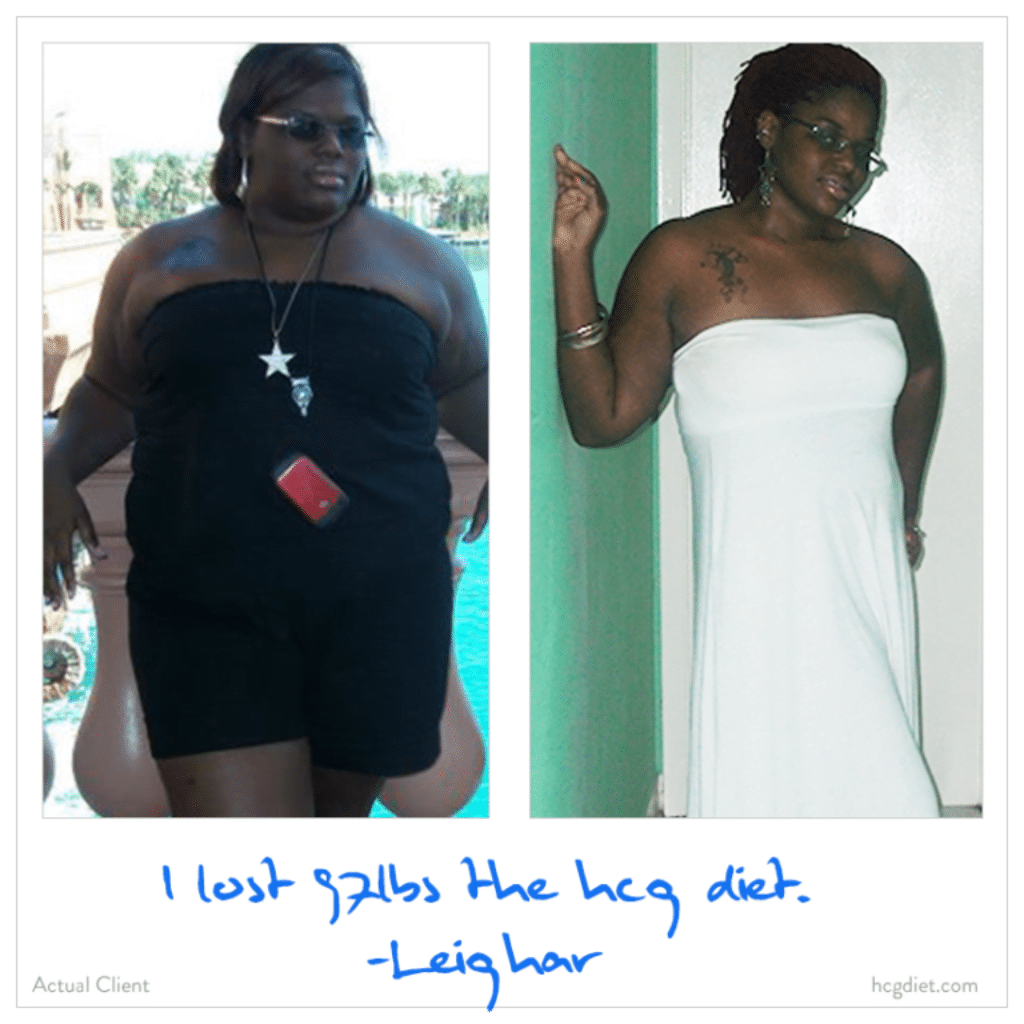 HCG Weight Loss success stories 2