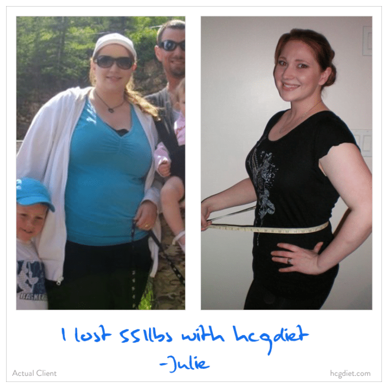 Julie's Gastric Sleeve Story, Success Stories